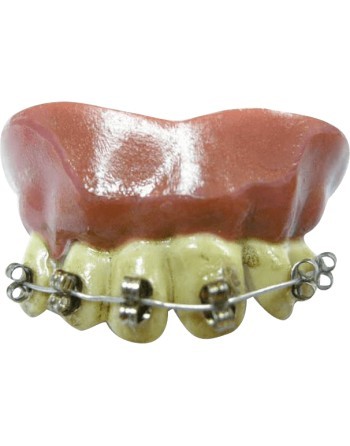 Dientes braquets