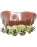 Dientes braquets