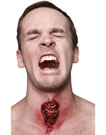 Appliance - traqueotomy