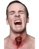 Appliance - traqueotomy