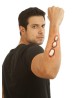 Appliance - Forearm Bones