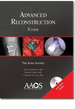 Advance Reconstruction: Knee