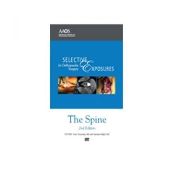 SEOS: Spine 2nd