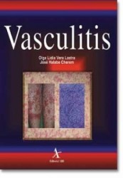 Vasculitis